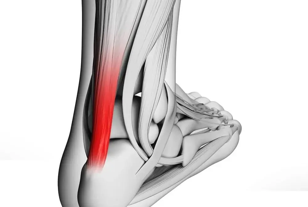 Tendonitis