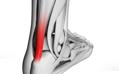 Tendonitis