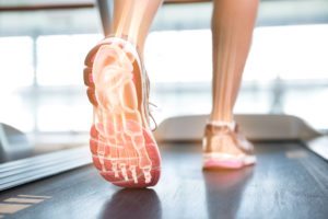 feet on treadmill with an overlay of an illustrated x-ray view of ankle and foot bones