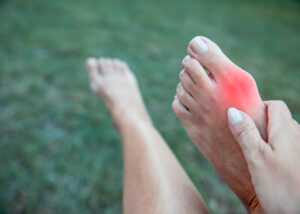 Woman feeling Discomfort outdoor taking off shoes cause Bone arthritis Pain. Massage bare foot Painful Bunion. Red highlit spot on feet