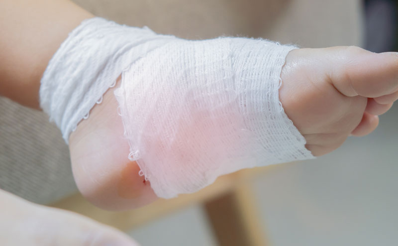 a foot with guase Bandage around it