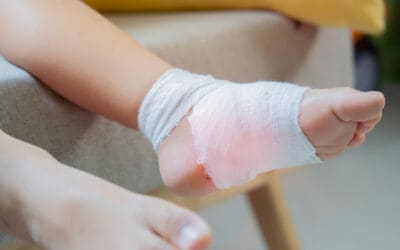 Is Your Child’s Flat Feet a Cause for Concern?