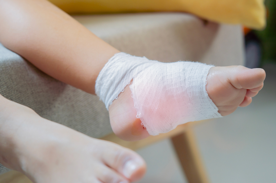 Little boy feet with gauze bandages
